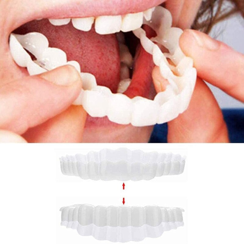 Instant Veneer Teeth